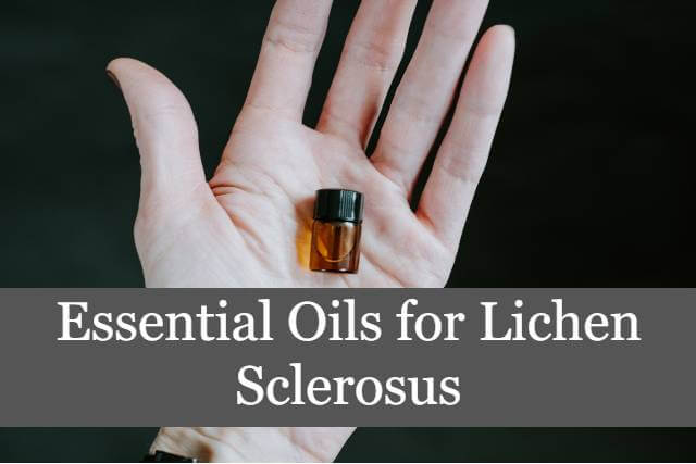 Essential Oils for Lichen Sclerosus