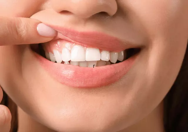 best essential oils for receding gums